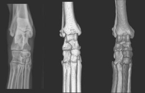 Tarsal Joint